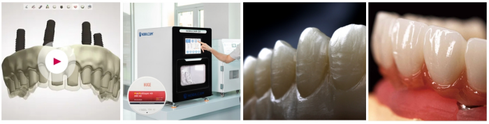 Discover the Future of Dental Excellence with HUGE Digitalife™ 9