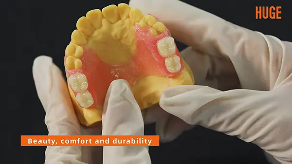 Flexible Partial Dentures Workflow