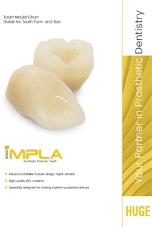 IMPLA Mould Chart